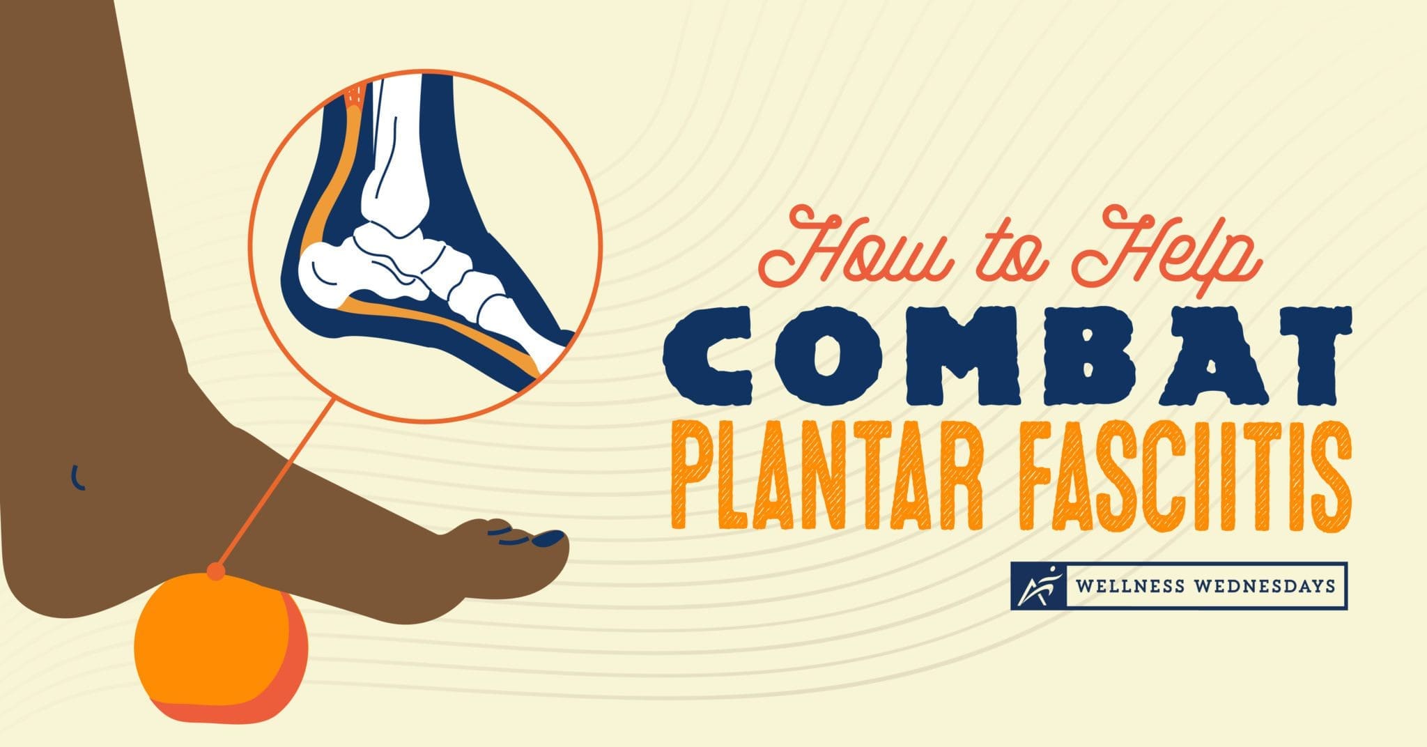 2022_03_ How to Combat Plantar Fasciitis _400222-01