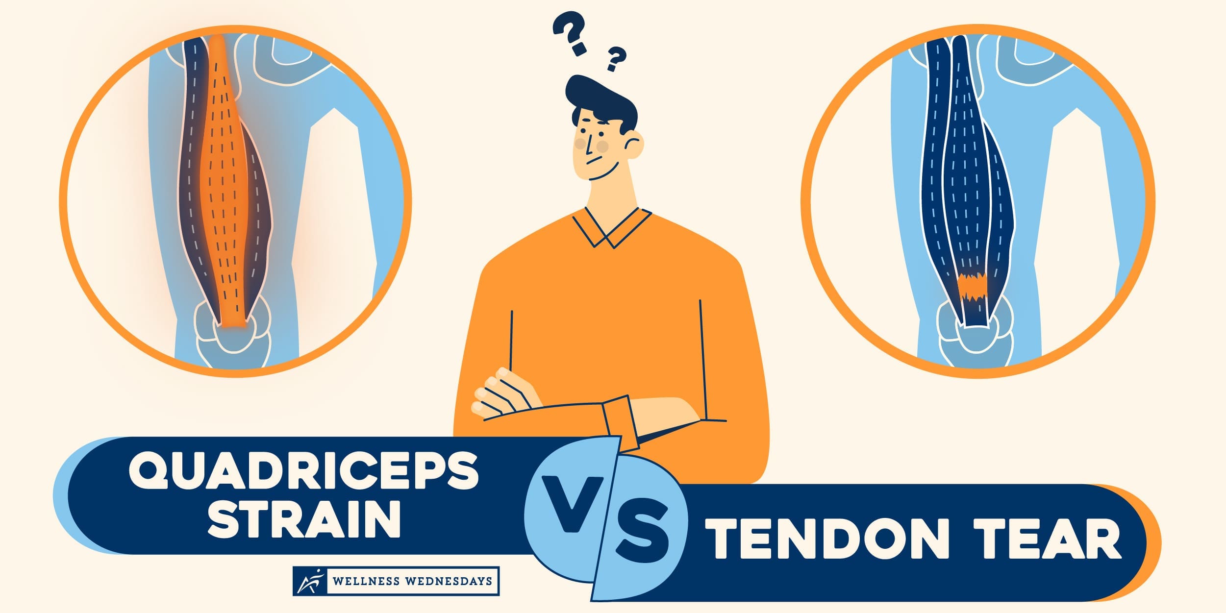 Quadriceps Tendon Tear vs. Quad Strain